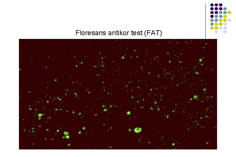 Floresans antikor test (FAT) Floresans antikor test (FAT)