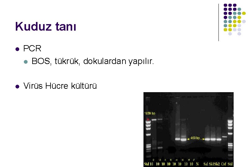 Kuduz tanı l PCR l BOS, tükrük, dokulardan yapılır. l Virüs Hücre kültürü Kuduz tanı l PCR l BOS, tükrük, dokulardan yapılır. l Virüs Hücre kültürü
