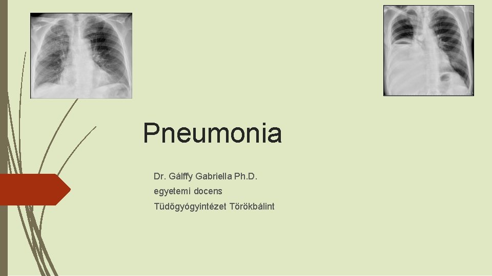 Pneumonia Dr. Gálffy Gabriella Ph. D. egyetemi docens Tüdőgyógyintézet Törökbálint 