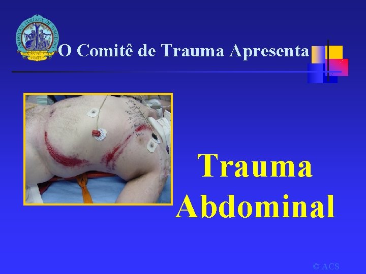 O Comitê de Trauma Apresenta Trauma Abdominal © ACS 