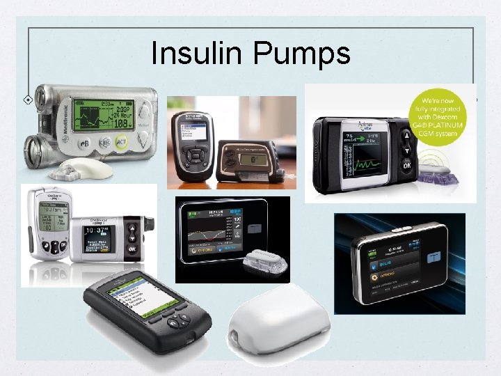 Insulin Pumps 