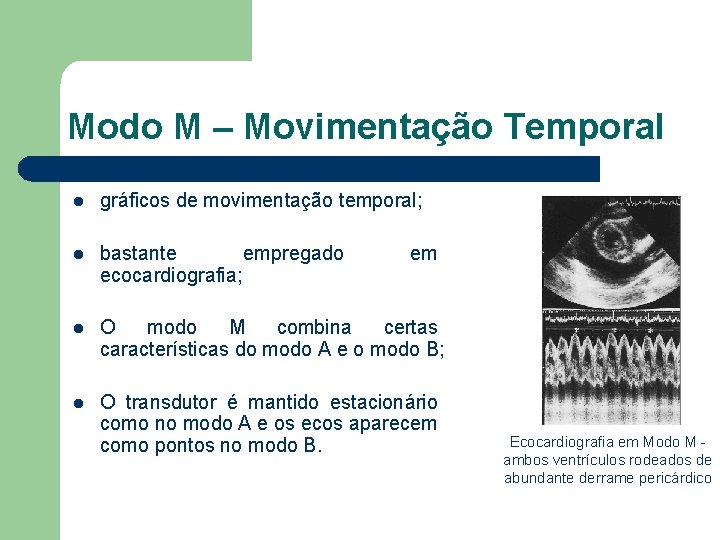 Modo M – Movimentação Temporal l gráficos de movimentação temporal; l bastante empregado ecocardiografia;