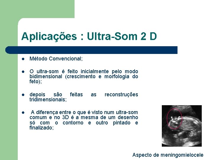 Aplicações : Ultra-Som 2 D l Método Convencional; l O ultra-som é feito inicialmente