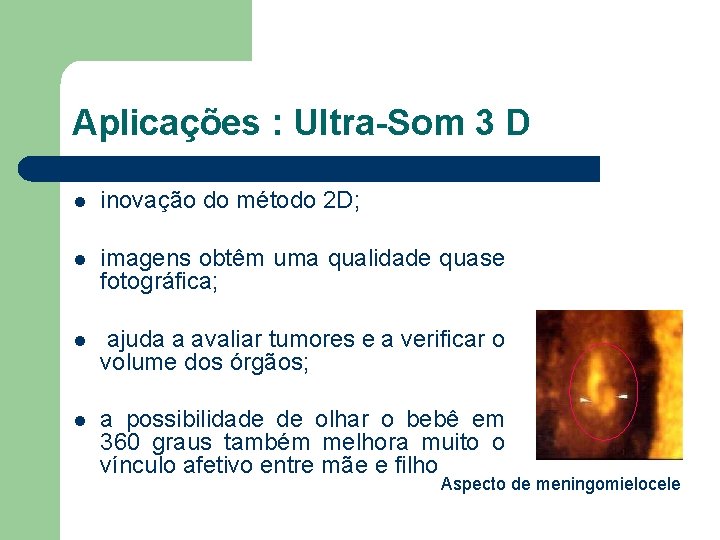 Aplicações : Ultra-Som 3 D l inovação do método 2 D; l imagens obtêm