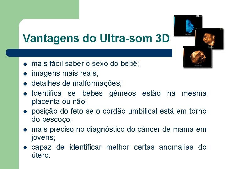 Vantagens do Ultra-som 3 D l l l l mais fácil saber o sexo