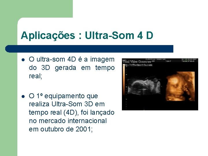 Aplicações : Ultra-Som 4 D l O ultra-som 4 D é a imagem do