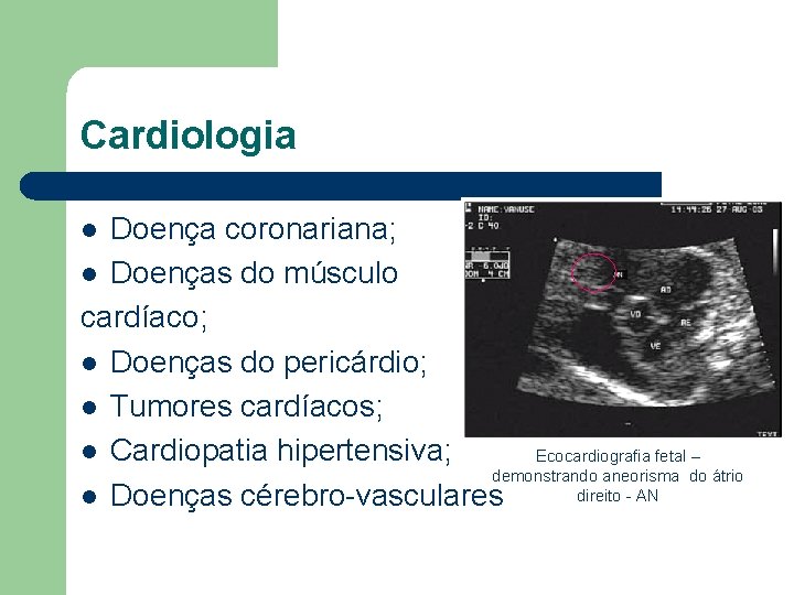 Cardiologia Doença coronariana; l Doenças do músculo cardíaco; l Doenças do pericárdio; l Tumores