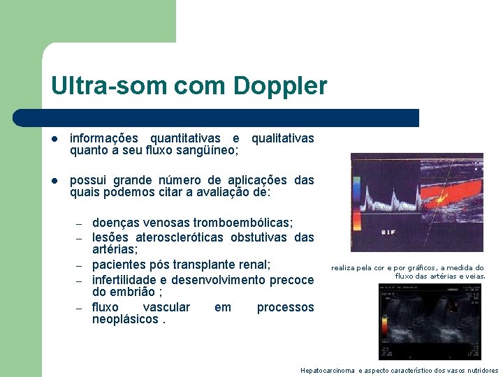 Ultra-som com Doppler l informações quantitativas e qualitativas quanto a seu fluxo sangüíneo; l