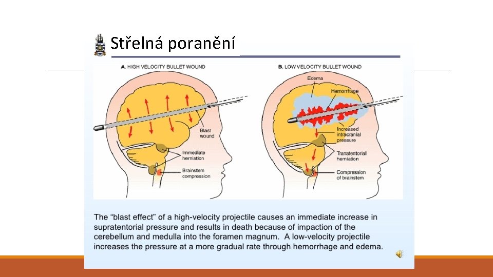 Střelná poranění Střelná poranění