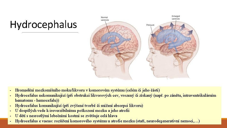 Hydrocephalus - Hromadění mozkomíšního moku/likvoru v komorovém systému (celém či jeho části) - Hydrocefalus