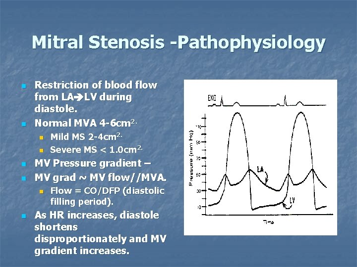 Mitral Stenosis -Pathophysiology n n Restriction of blood flow from LA LV during diastole.