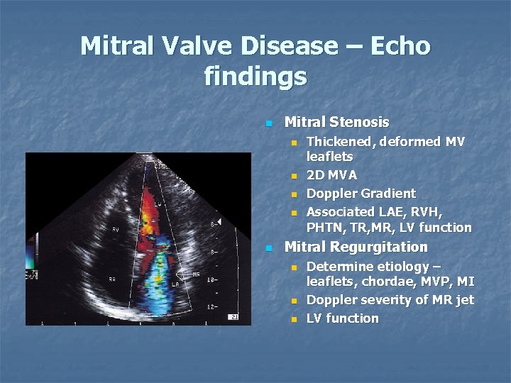 Mitral Valve Disease – Echo findings n Mitral Stenosis n n n Thickened, deformed