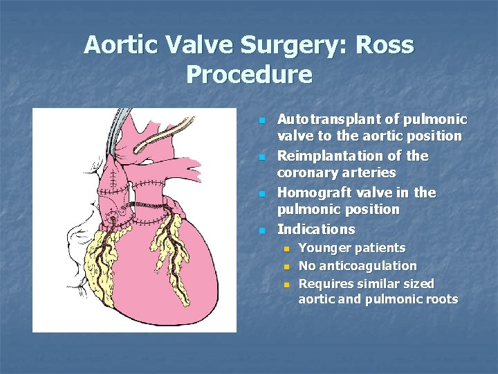 Aortic Valve Surgery: Ross Procedure n n Autotransplant of pulmonic valve to the aortic