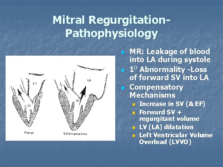 Mitral Regurgitation. Pathophysiology n n n MR: Leakage of blood into LA during systole