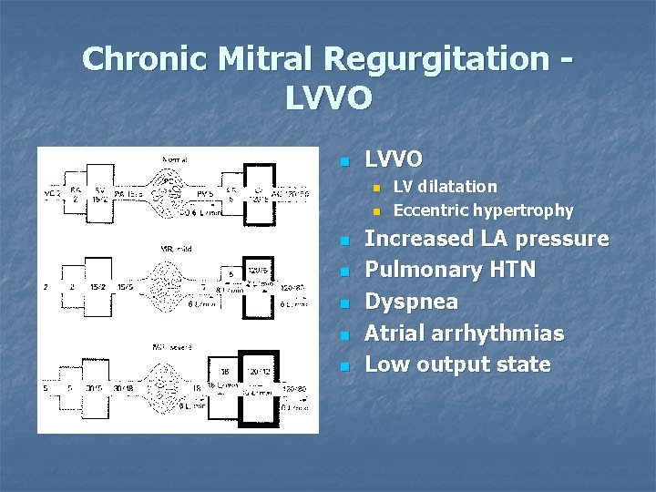 Chronic Mitral Regurgitation LVVO n n n n LV dilatation Eccentric hypertrophy Increased LA