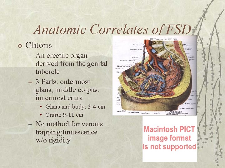 Anatomic Correlates of FSD v Clitoris – An erectile organ derived from the genital