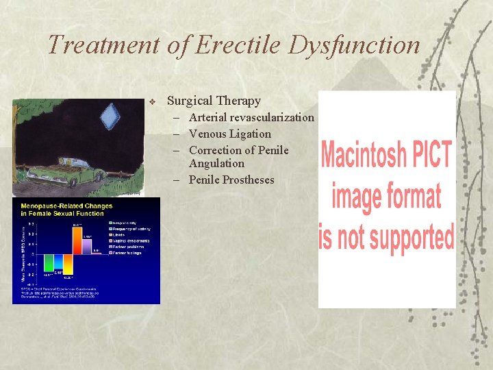 Treatment of Erectile Dysfunction v Surgical Therapy – Arterial revascularization – Venous Ligation –