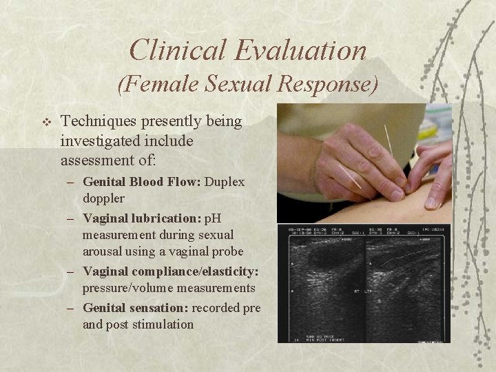 Clinical Evaluation (Female Sexual Response) v Techniques presently being investigated include assessment of: –