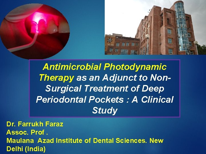 Antimicrobial Photodynamic Therapy as an Adjunct to Non. Surgical Treatment of Deep Periodontal Pockets