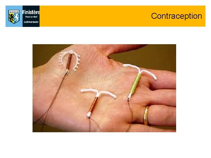Contraception Contraception