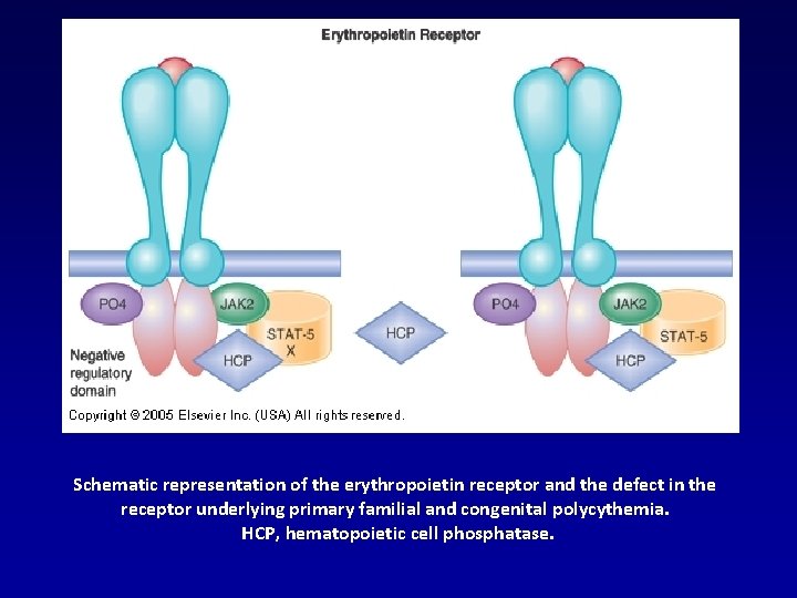  Schematic representation of the erythropoietin receptor and the defect in the receptor underlying