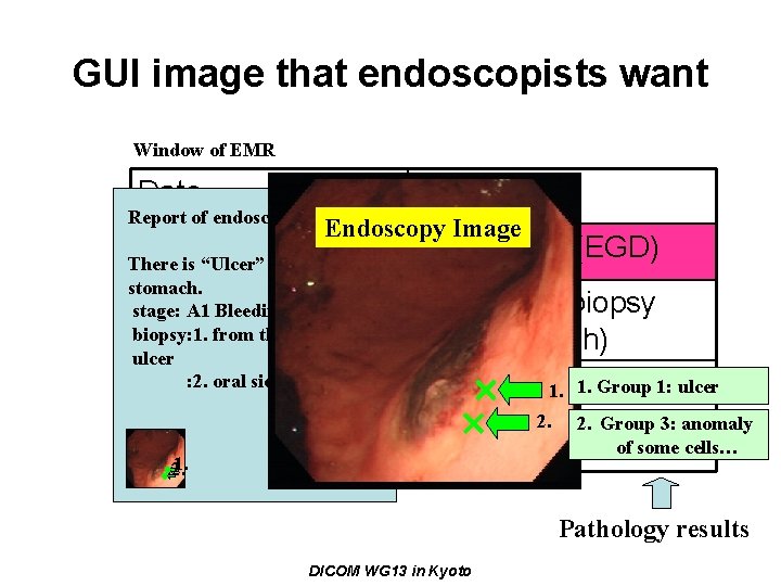 GUI image that endoscopists want Window of EMR Date Report of endoscopy 2007/10/30 Event