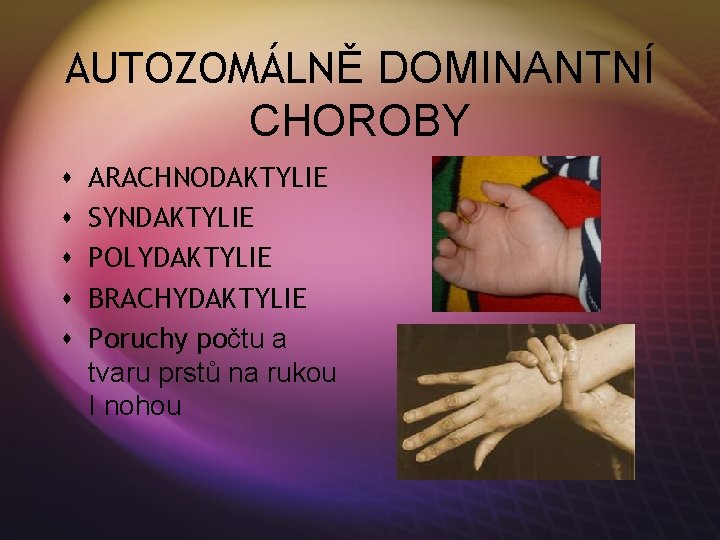 AUTOZOMÁLNĚ DOMINANTNÍ CHOROBY s s s ARACHNODAKTYLIE SYNDAKTYLIE POLYDAKTYLIE BRACHYDAKTYLIE Poruchy počtu a tvaru