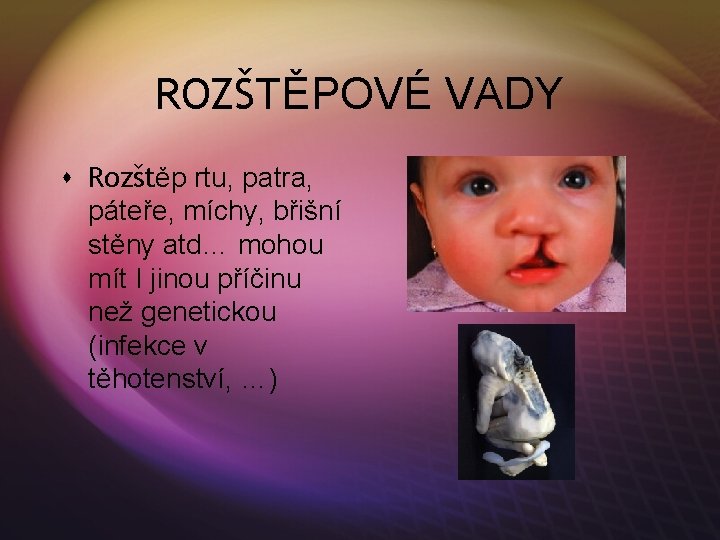 ROZŠTĚPOVÉ VADY s Rozštěp rtu, patra, páteře, míchy, břišní stěny atd… mohou mít I