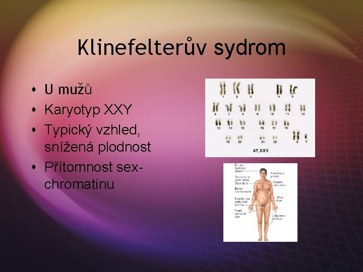 Klinefelterův sydrom s U mužů s Karyotyp XXY s Typický vzhled, snížená plodnost s