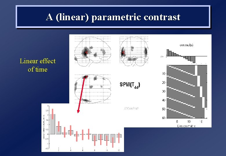 A (linear) parametric contrast Linear effect of time 