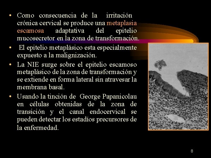  • Como consecuencia de la irritación crónica cervical se produce una metaplasia escamosa