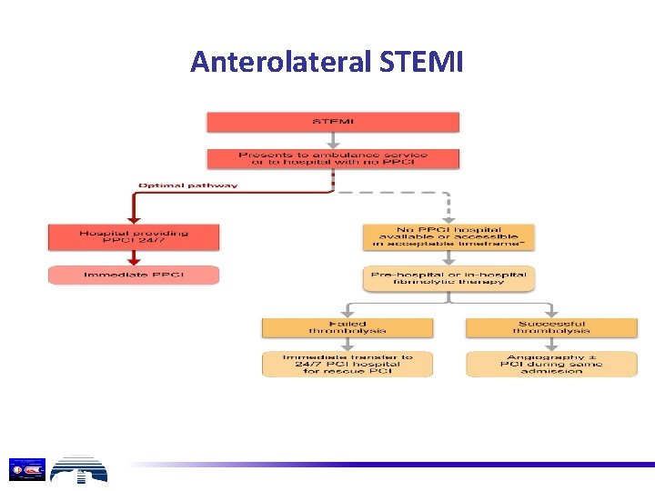 Anterolateral STEMI 