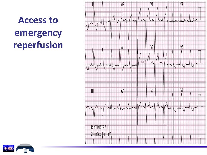 Access to emergency reperfusion 