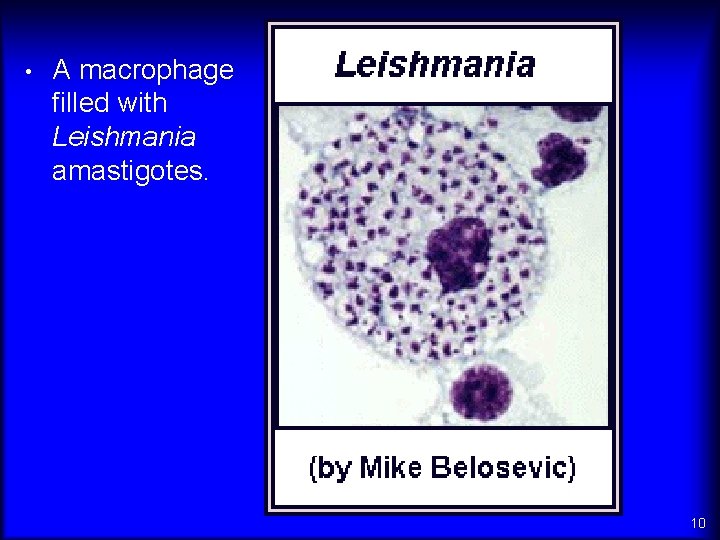  • A macrophage filled with Leishmania amastigotes. 10 