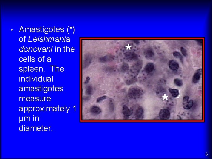  • Amastigotes (*) of Leishmania donovani in the cells of a spleen. The