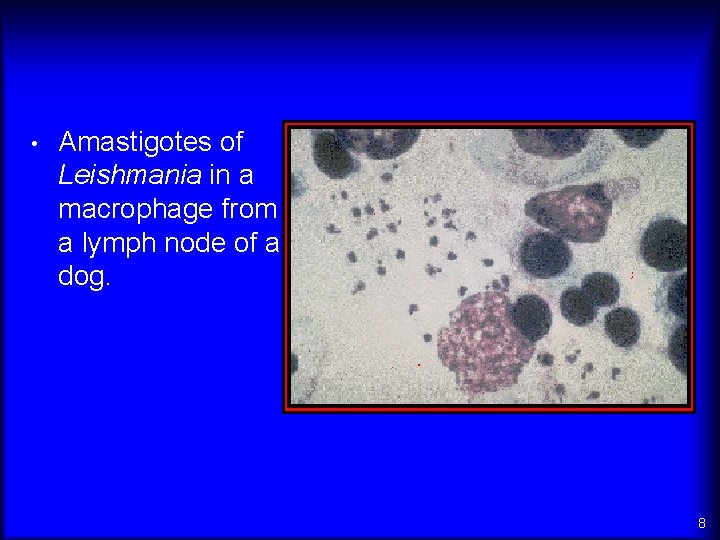  • Amastigotes of Leishmania in a macrophage from a lymph node of a