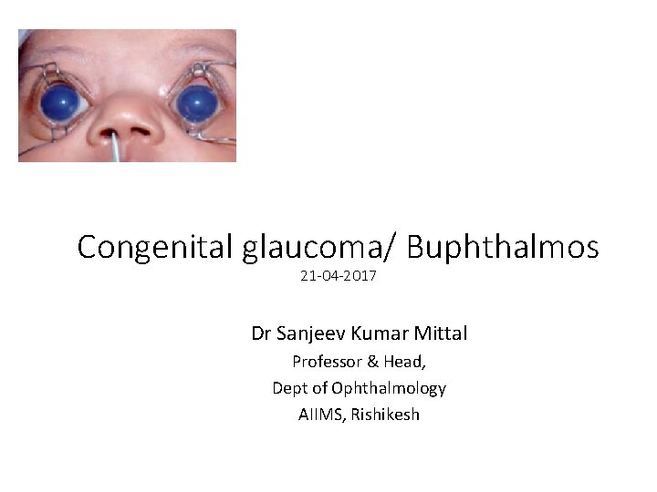 Congenital glaucoma/ Buphthalmos 21 -04 -2017 Dr Sanjeev Kumar Mittal Professor & Head, Dept
