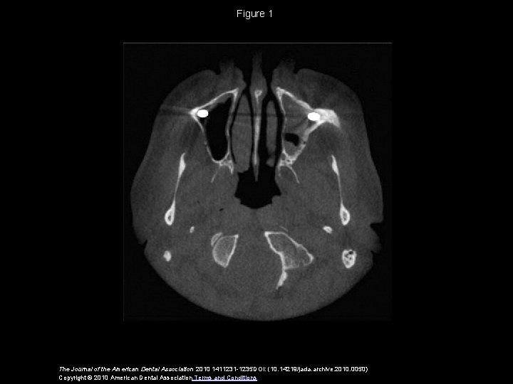 Figure 1 The Journal of the American Dental Association 2010 1411231 -1235 DOI: (10.