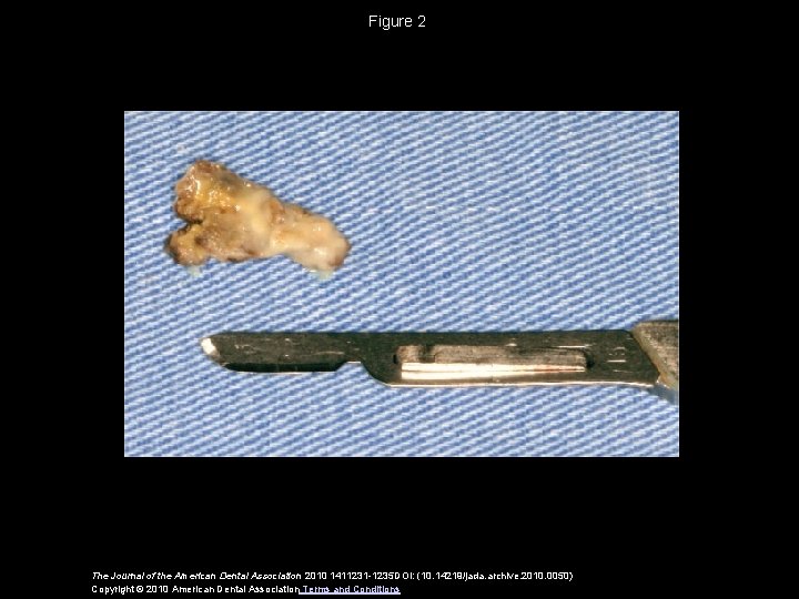 Figure 2 The Journal of the American Dental Association 2010 1411231 -1235 DOI: (10.