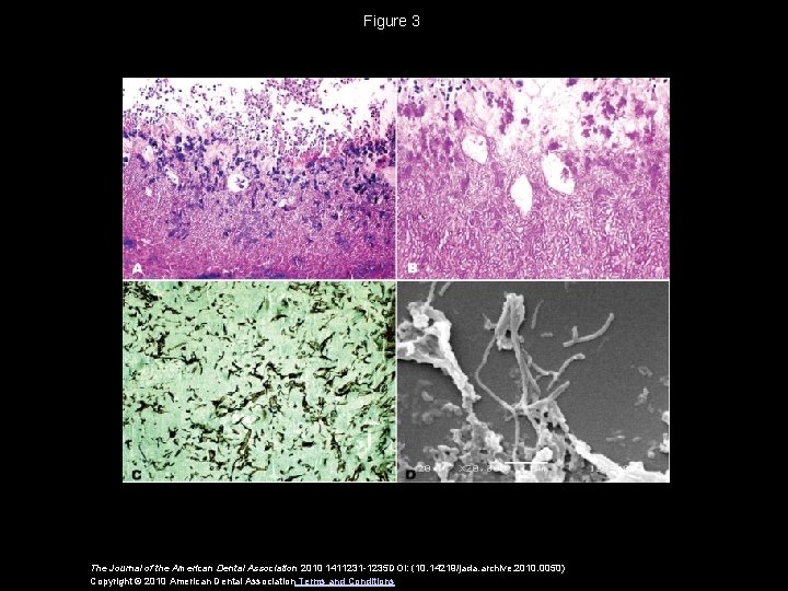 Figure 3 The Journal of the American Dental Association 2010 1411231 -1235 DOI: (10.