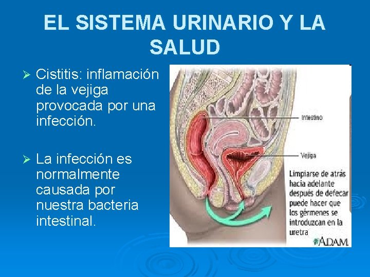 EL SISTEMA URINARIO Y LA SALUD Ø Cistitis: inflamación de la vejiga provocada por