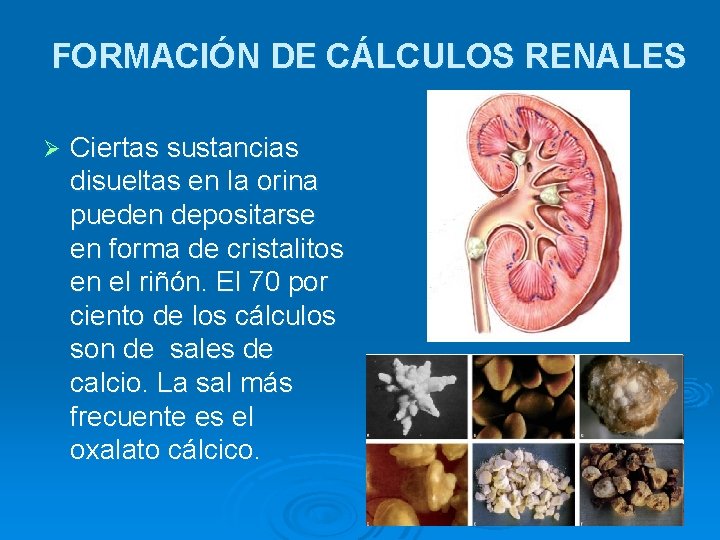 FORMACIÓN DE CÁLCULOS RENALES Ø Ciertas sustancias disueltas en la orina pueden depositarse en