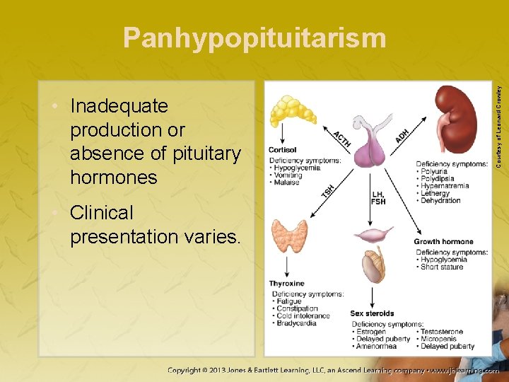  • Inadequate production or absence of pituitary hormones • Clinical presentation varies. Courtesy