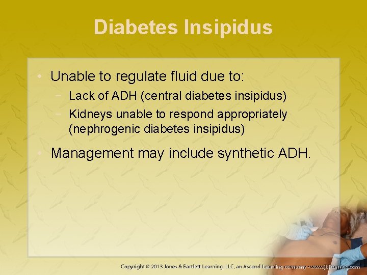 Diabetes Insipidus • Unable to regulate fluid due to: − Lack of ADH (central