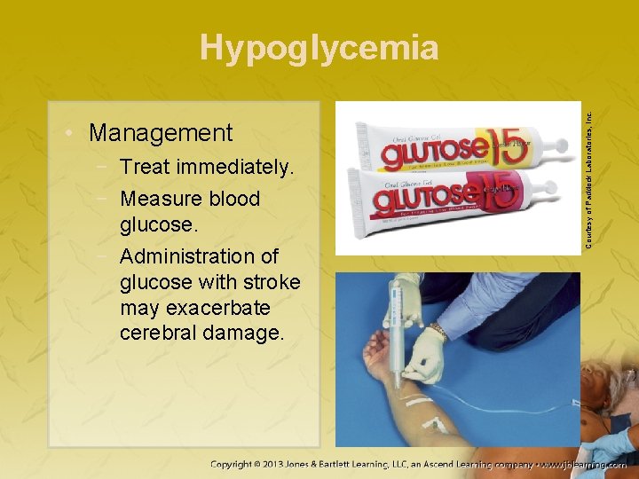  • Management − Treat immediately. − Measure blood glucose. − Administration of glucose