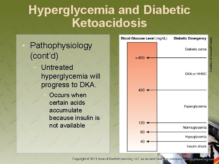  • Pathophysiology (cont’d) − Untreated hyperglycemia will progress to DKA. • Occurs when