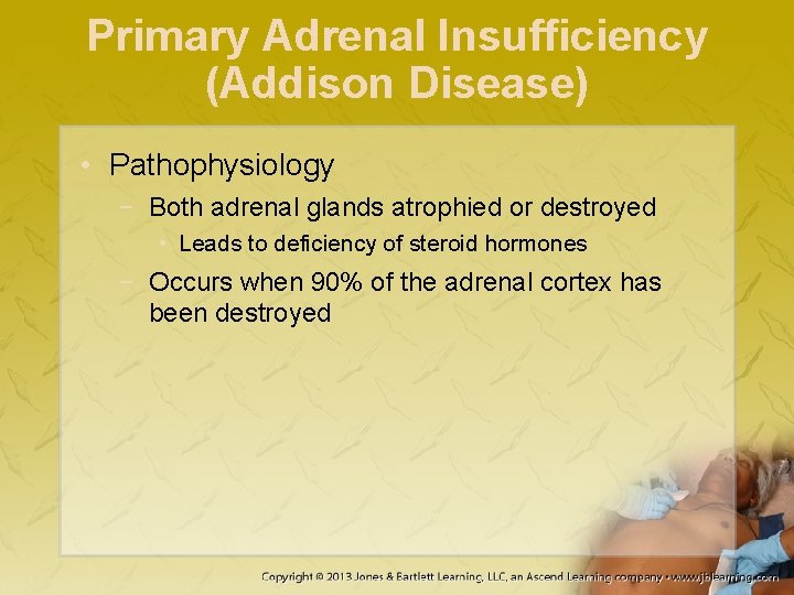 Primary Adrenal Insufficiency (Addison Disease) • Pathophysiology − Both adrenal glands atrophied or destroyed