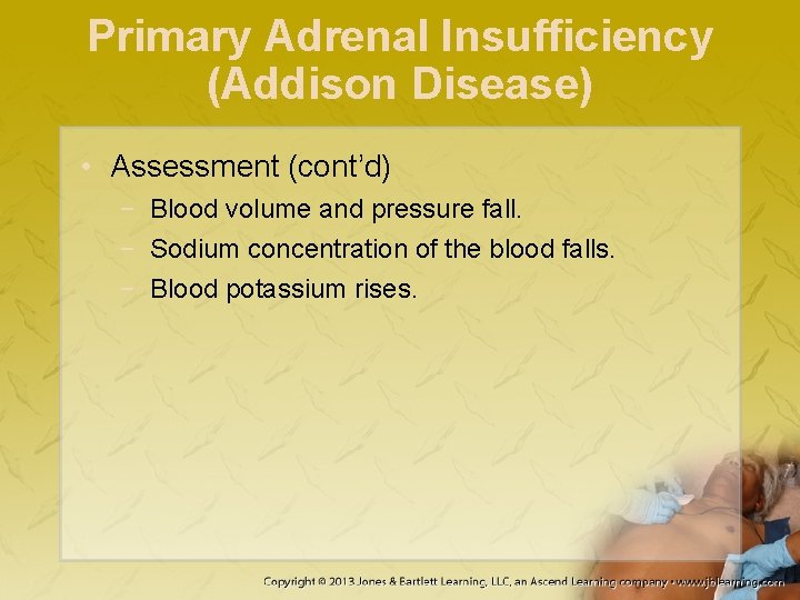 Primary Adrenal Insufficiency (Addison Disease) • Assessment (cont’d) − Blood volume and pressure fall.