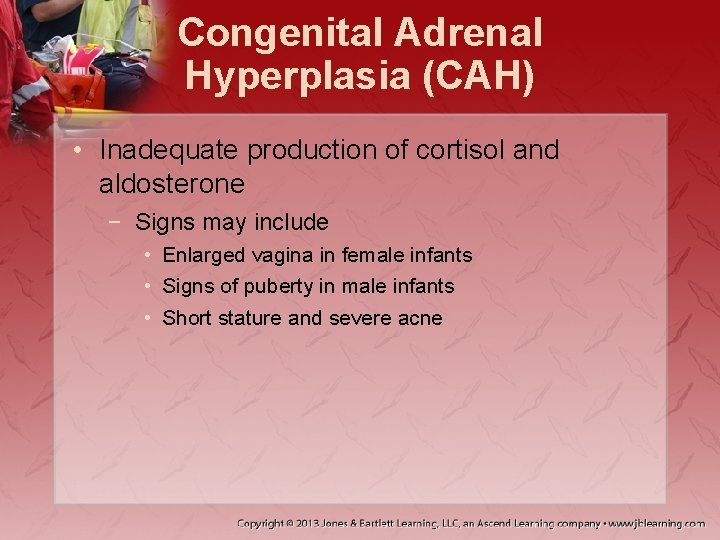 Congenital Adrenal Hyperplasia (CAH) • Inadequate production of cortisol and aldosterone − Signs may
