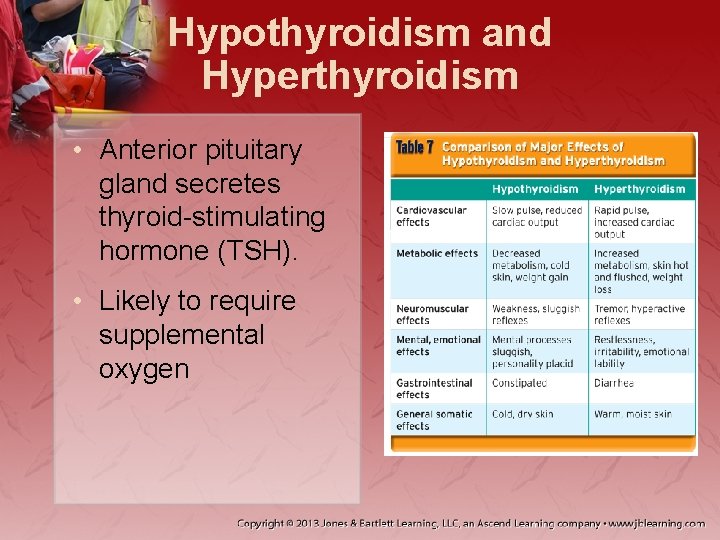 Hypothyroidism and Hyperthyroidism • Anterior pituitary gland secretes thyroid-stimulating hormone (TSH). • Likely to